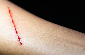 Bloodborne Pathogens (US)