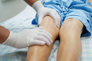 The Lymphatic System in Scar Wound Healing
