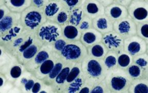 Philip Harris Prepared Microscope Slide Set - Mitosis and Meiosis - Set 1 - Set of 6 Slides